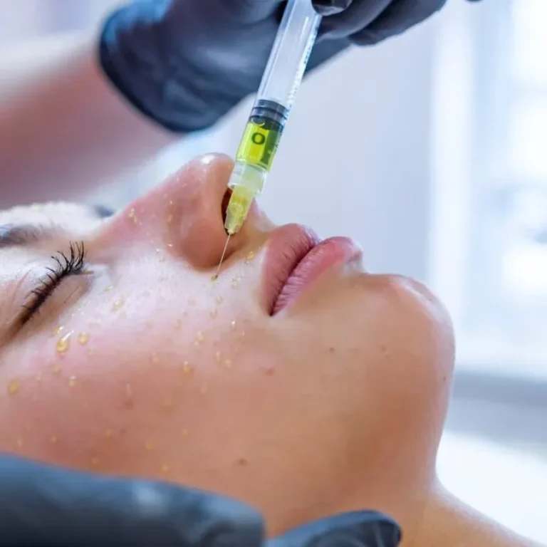 Mesoterapia-facial-con-vitaminas-y-acido-hialuronico-scaled-e1574079829105