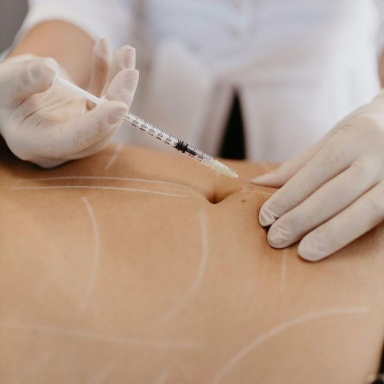 ReducciónGrasaLocalizada